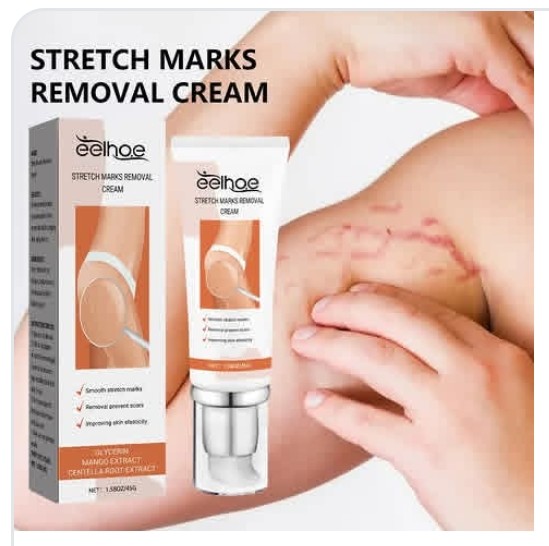 Stretch Marks Removal Cream